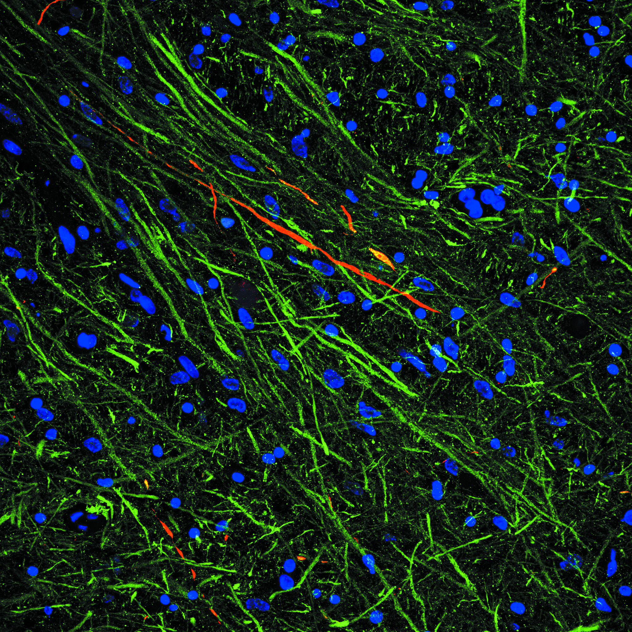 Deciphering the effects of COVID-19 on the Brain