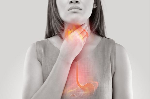 Appropriate reflux management in pharmacy