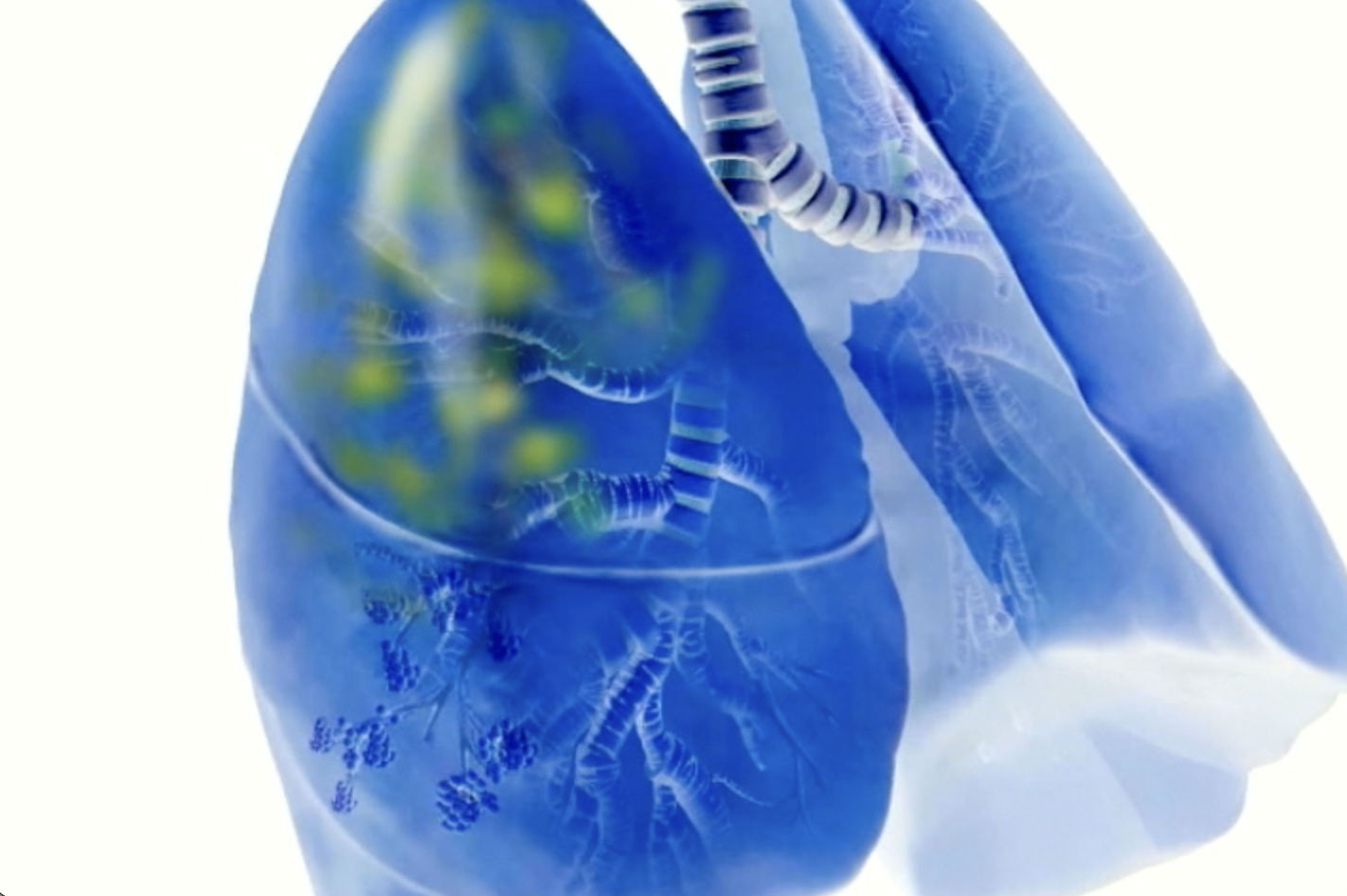 mRNA-Encoded "Mini-Antibodies": A Next-Generation Shield Against Multidrug-Resistant Bacteria
