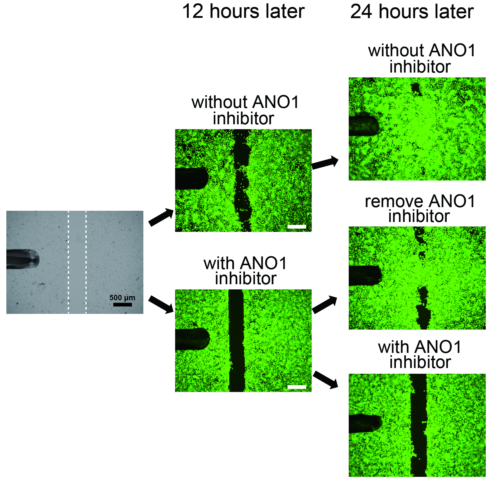 TRPV3/ANO1 interaction in wound healing