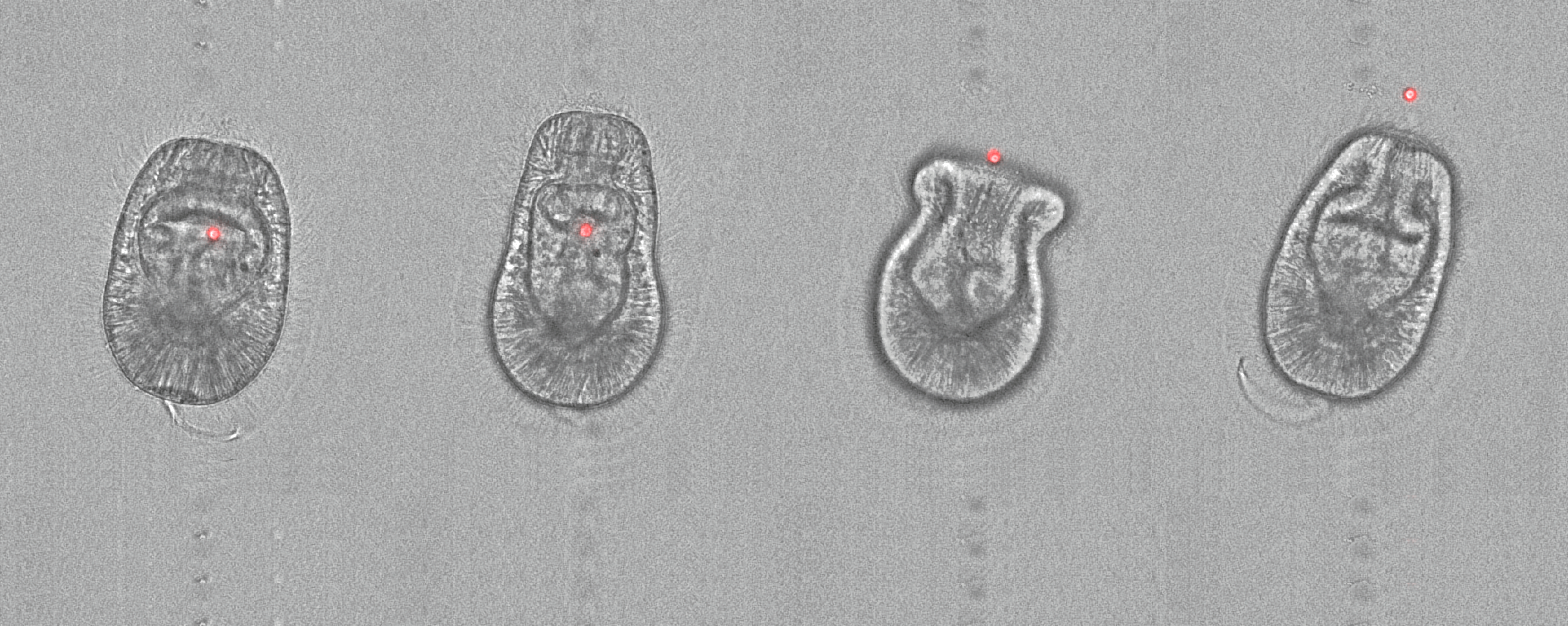 Vomocytosis: sick of non-symbiotic microorganisms