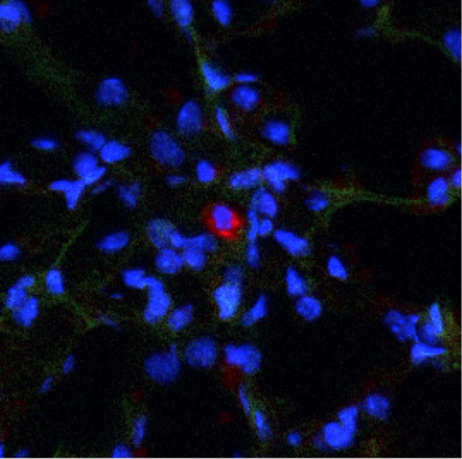 Metastatic dormancy in breast cancer depends on CD39+ PD-1+ CD8+ T cells 