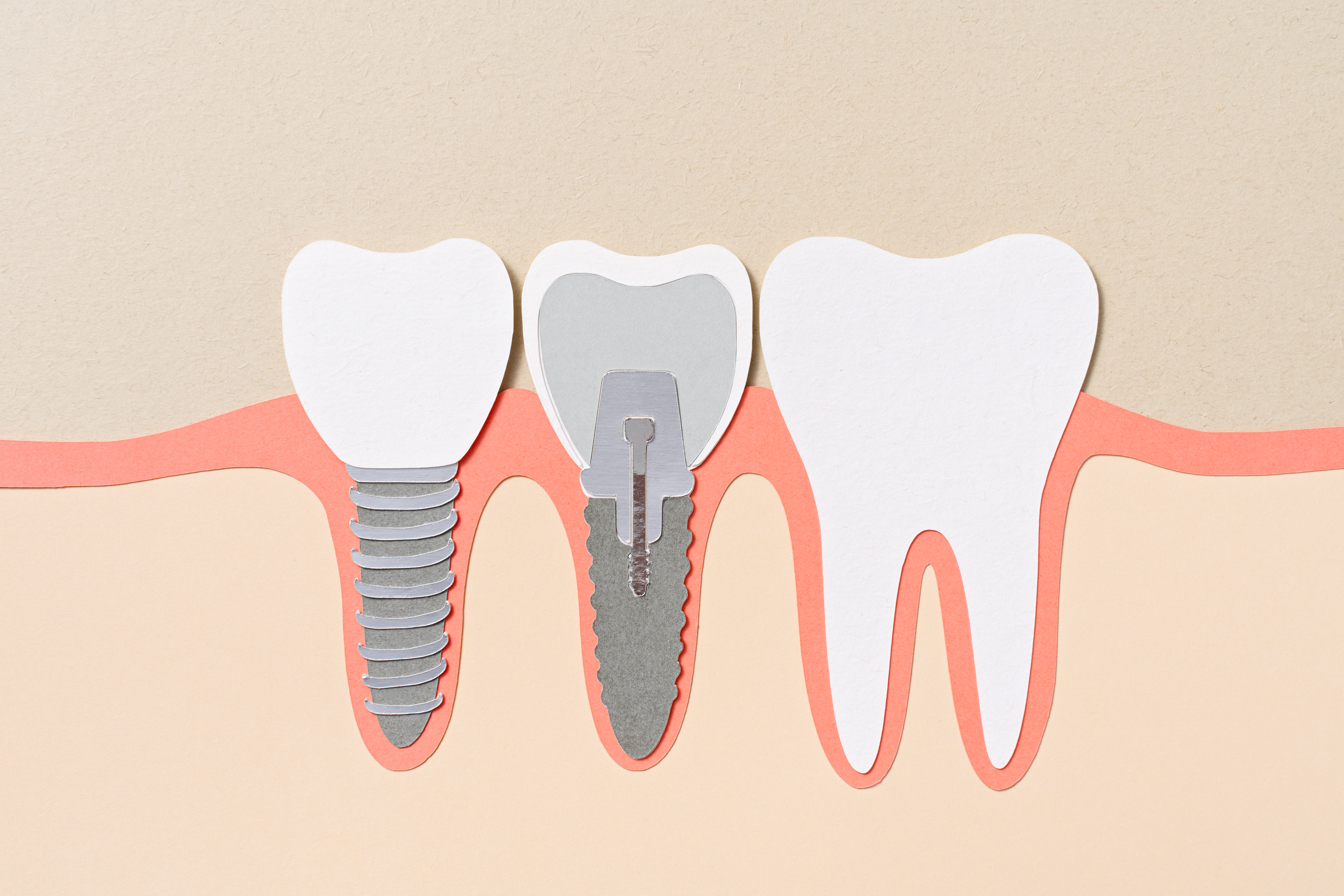 Oral Health and Noncommunicable Diseases