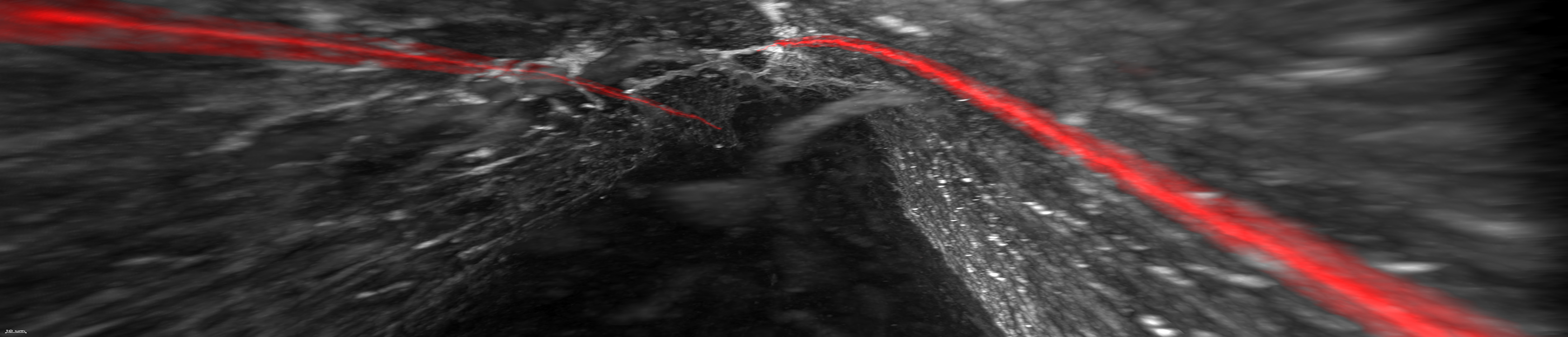 LYMPHATIC VESSELS AS A UNIVERSAL TRAP FOR PARASITIC NEMATODES 
