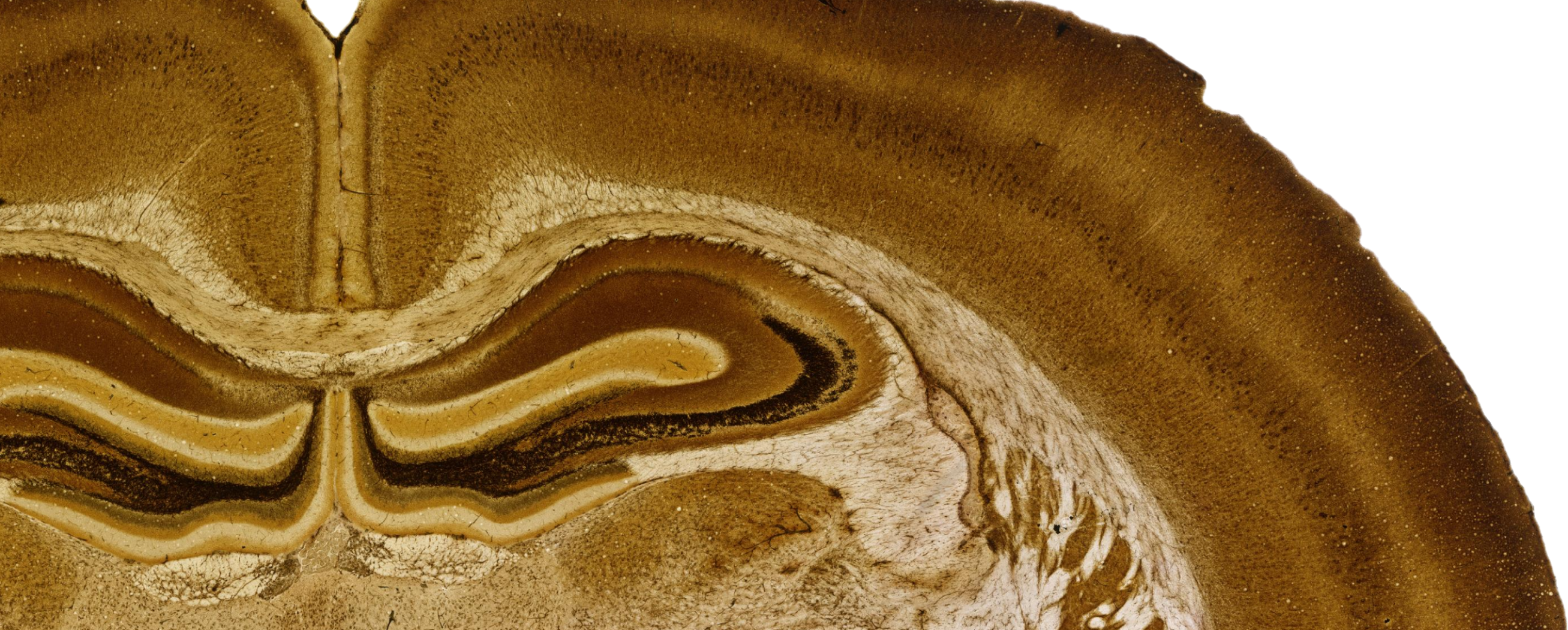 Finding gold in silver-stained rat brains 