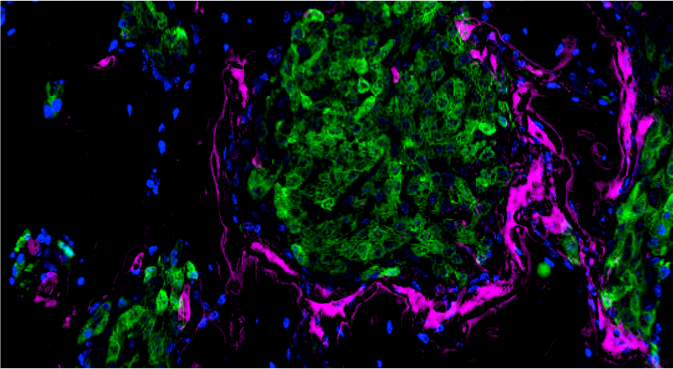 Tumor-Osteoclast Spatiotemporal Coupling: A Cell Behavior Target for Bone Metastasis Prevention