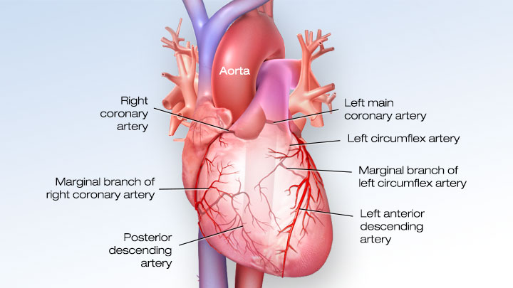 Stent technology in the treatment of coronary artery disease