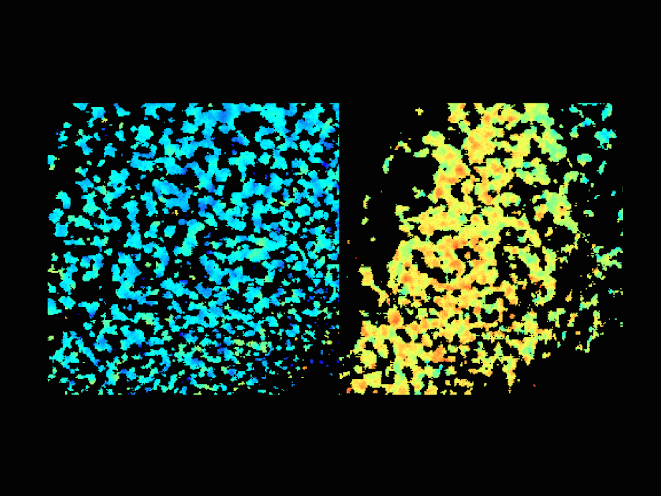 Who else can stop HIV-1 reverse transcriptase?