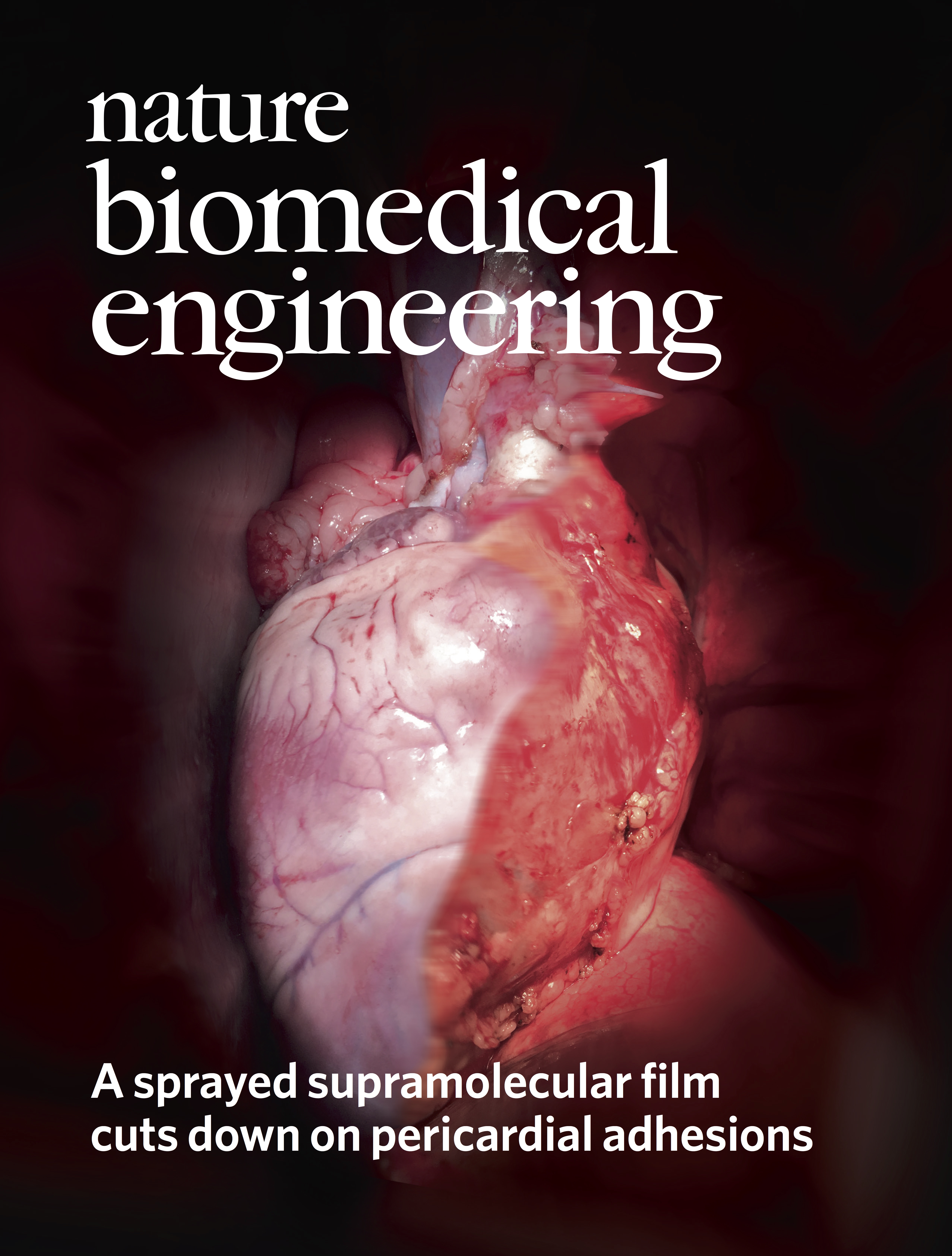 Preventing post-operative adhesions with a sprayable viscoelastic hydrogel