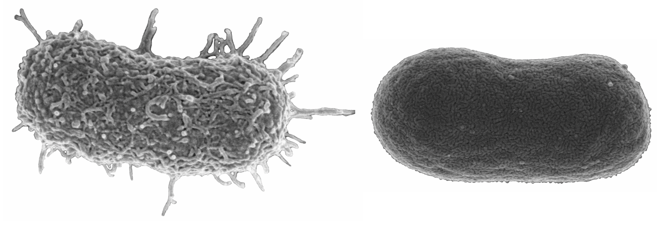 Giving Acinetobacter baumannii a choice: death by phage or death by antibiotic