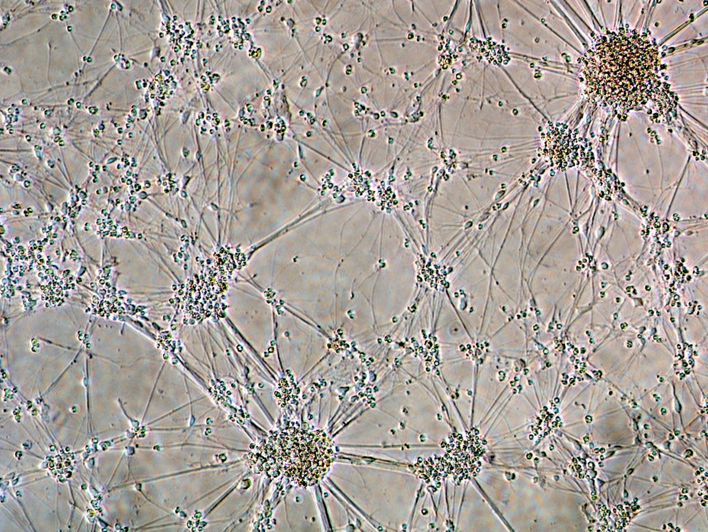 Why infection with herpes virus leads to encephalitis in a minority of children?