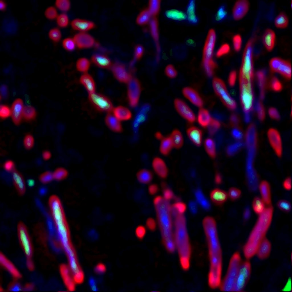 Where do antibiotics go within cells?  The impact of mycobacterial intracellular lifestyle in tuberculosis chemotherapy