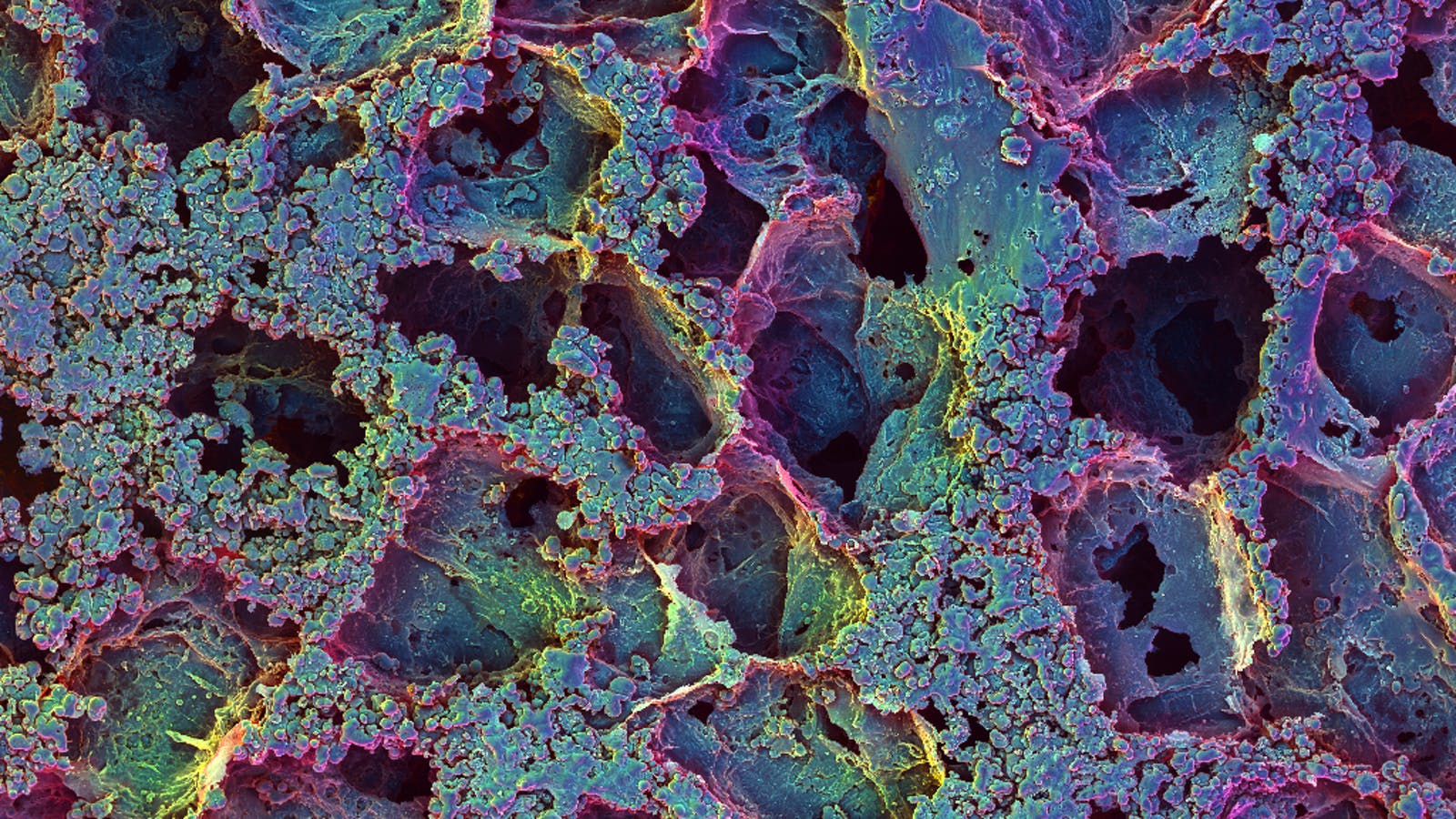 Immune Engineering - Development of Immuno-Materials 