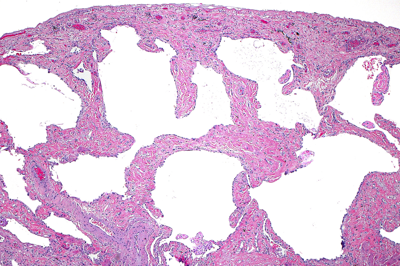 Call for papers: Mechanisms of Tissue Fibrosis