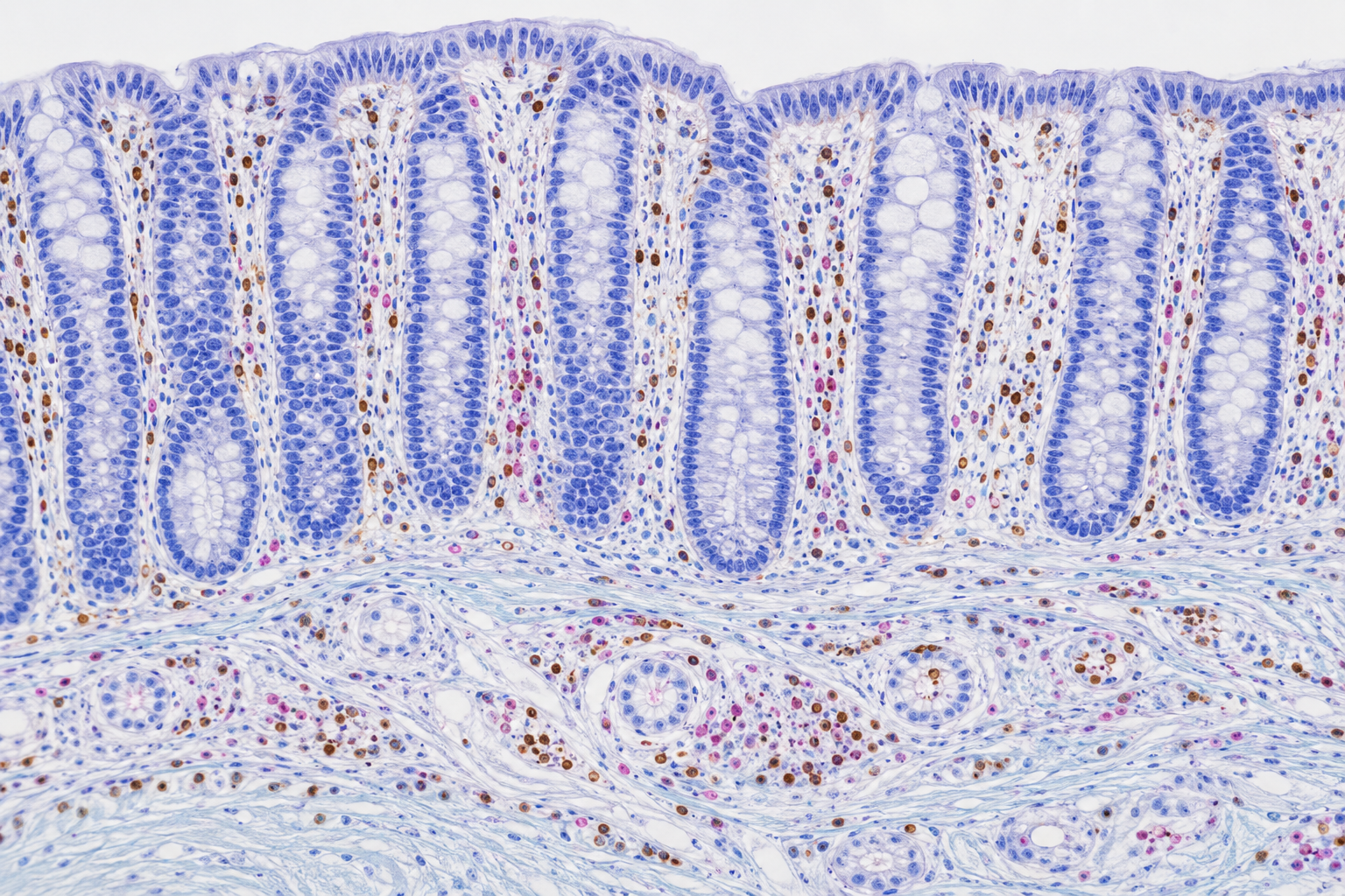 Intercepting cancer before it begins: A 2050 perspective