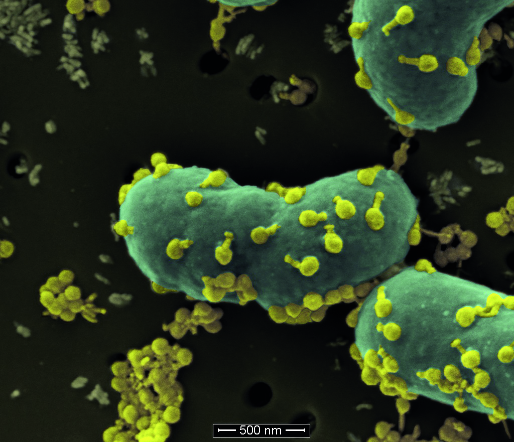 The Art of Killing a Superbug