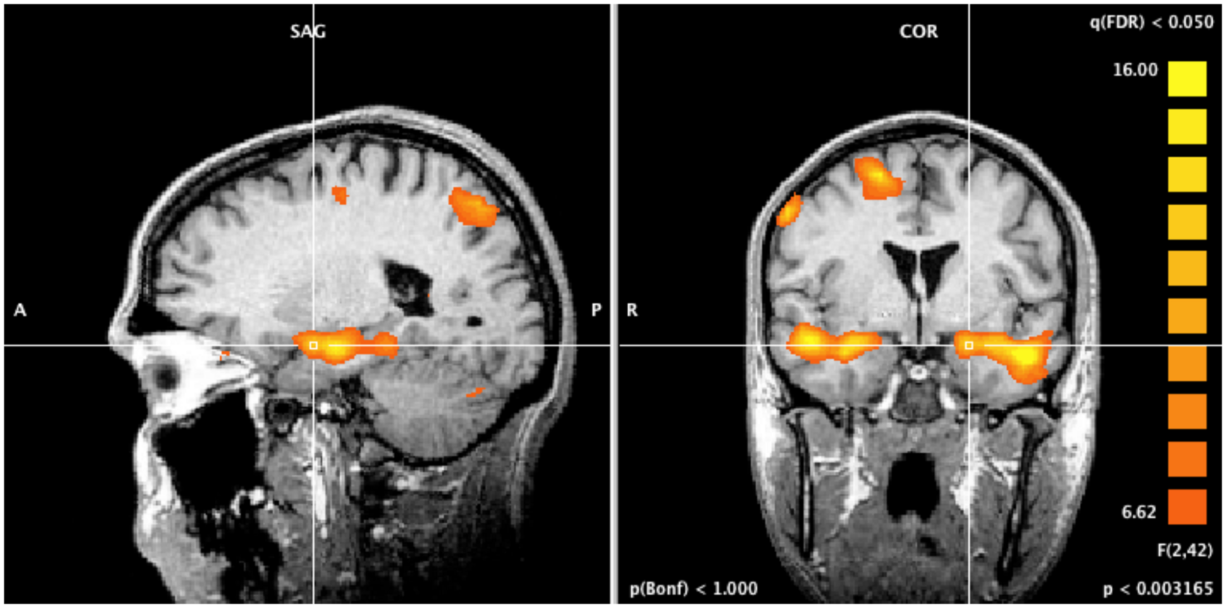 Project Outline: Physiological Responses to Racism-Related Stress and Mental Health Symptoms