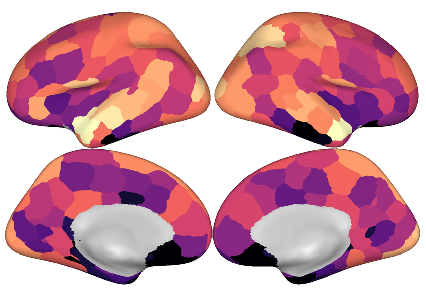 Watching the brain watching a movie, or how naturalistic fMRI can reveal the brain’s inner workings