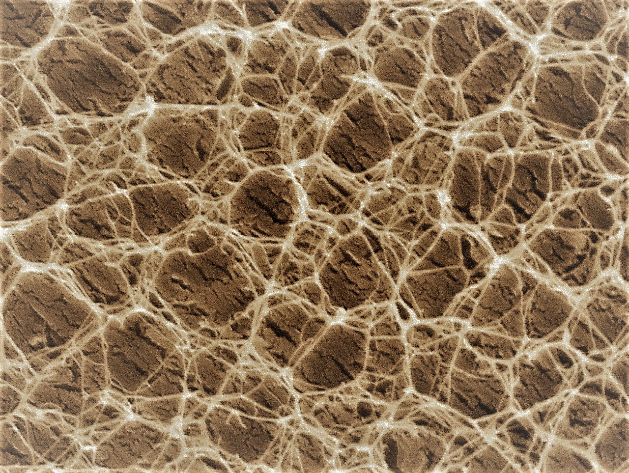 Hydrogel stabilisation: Crosslinking without disadvantages