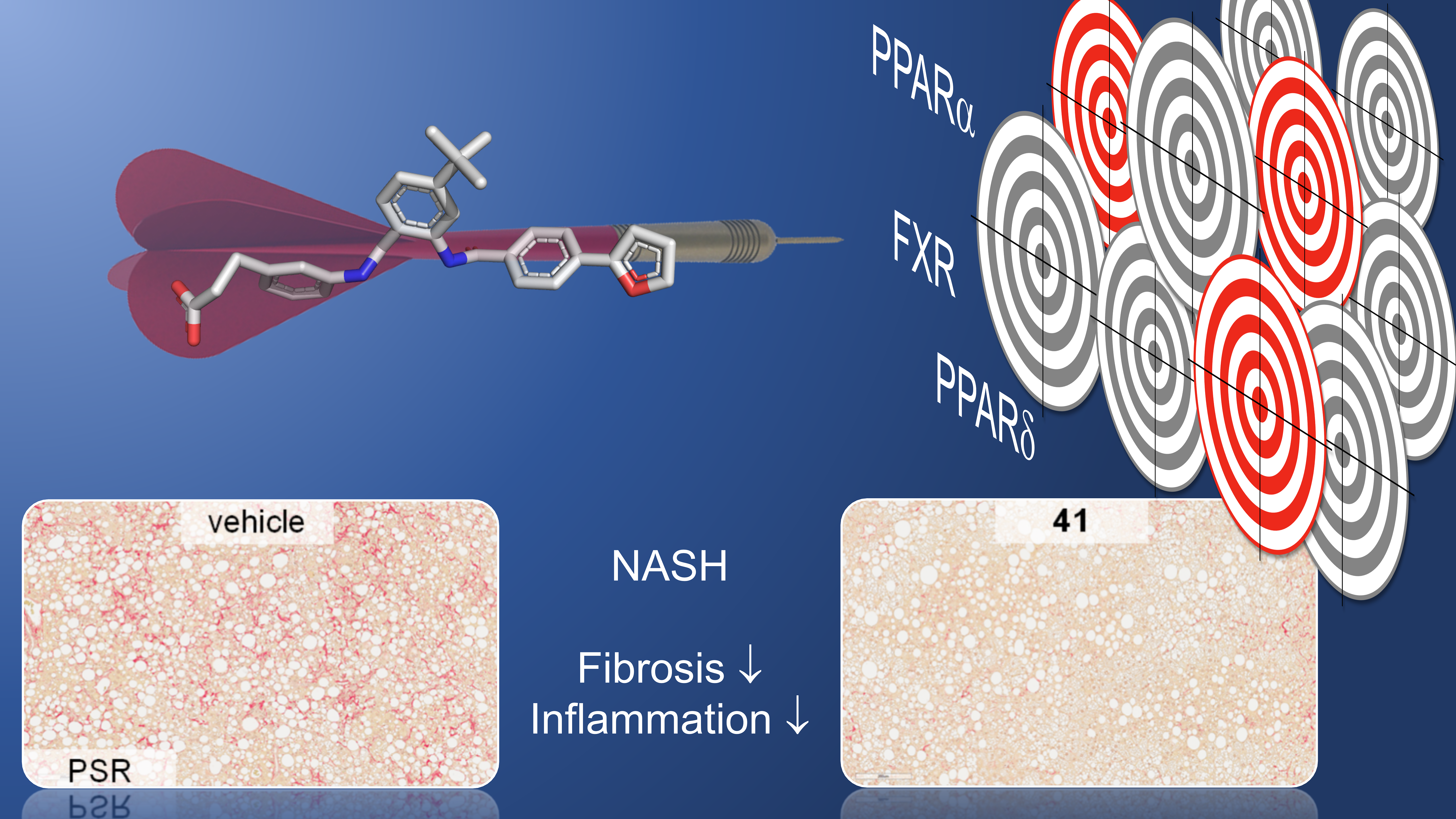 Designed polypharmacology to counteract multifactorial NASH