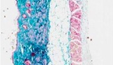npj Microgravity Article: Skin physiology in microgravity: a 3-month stay aboard ISS induces dermal atrophy and affects cutaneous muscle and hair follicles cycling in mice