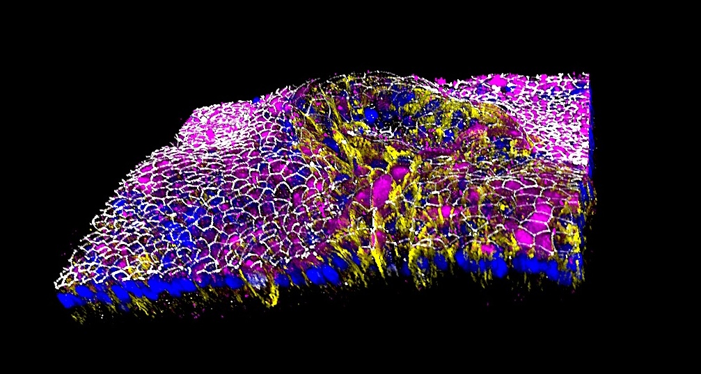 Building the human alveolar epithelium in vitro: why achieving developmental stages matters 