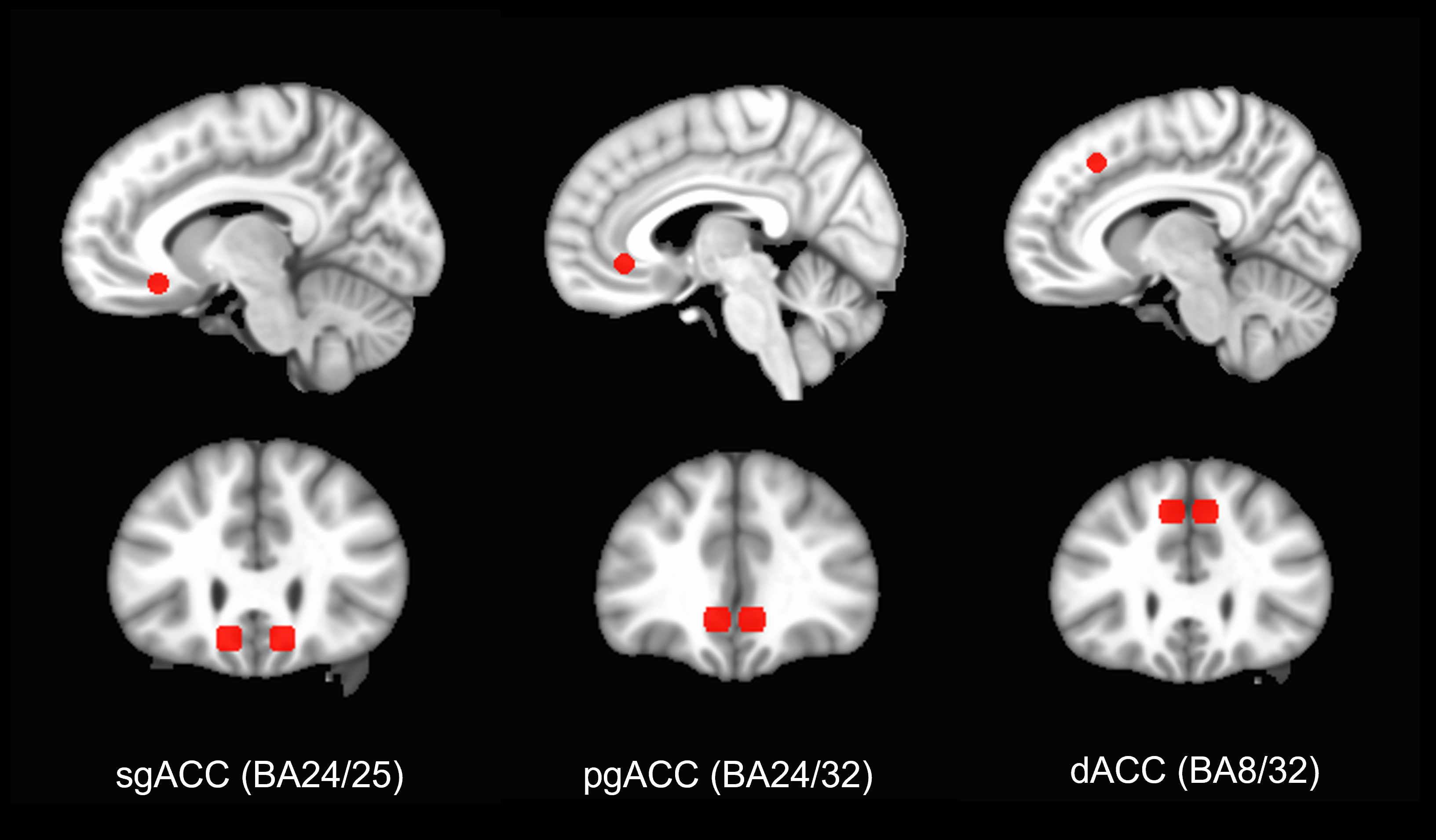 Ketamine's antidepressant effects involve an evolutionarily ancient part of the brain