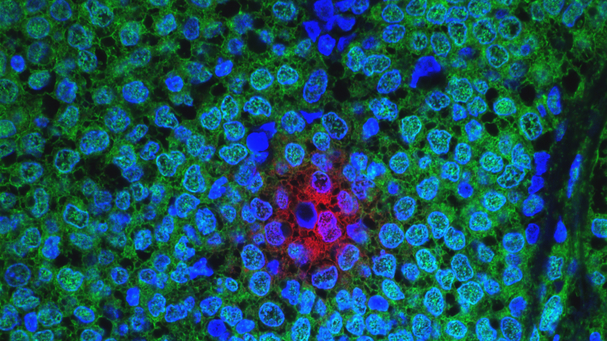 Call for papers: Tumour Cell Plasticity & Non Genetic Heterogeneity