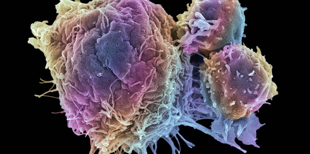 Top 100 in Cancer 2023 | Scientific Reports
