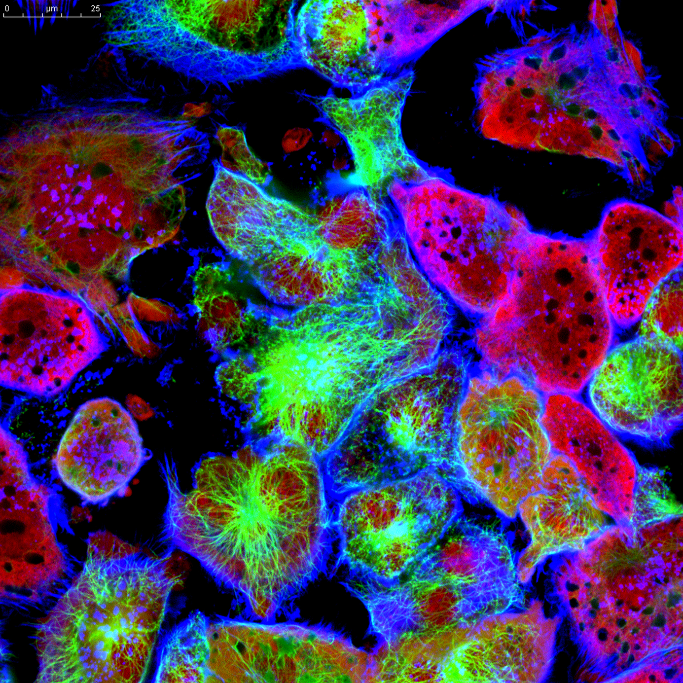 Project: Chemical Inhibition of Autophagy