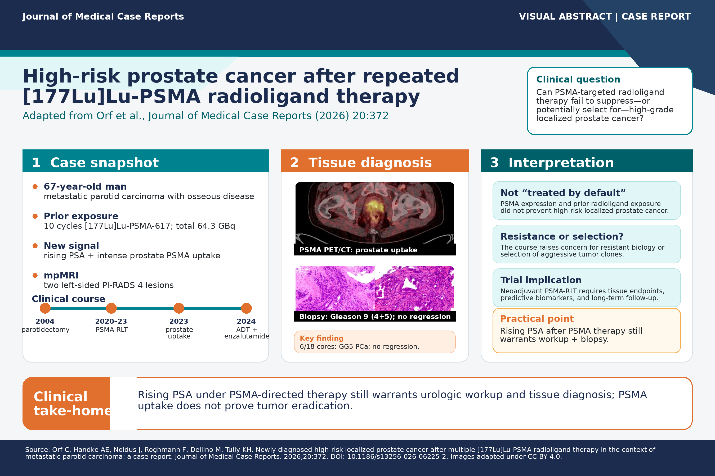 When PSMA-targeted therapy is not enough: high-risk localized prostate cancer after repeated [177Lu]Lu-PSMA radioligand therapy