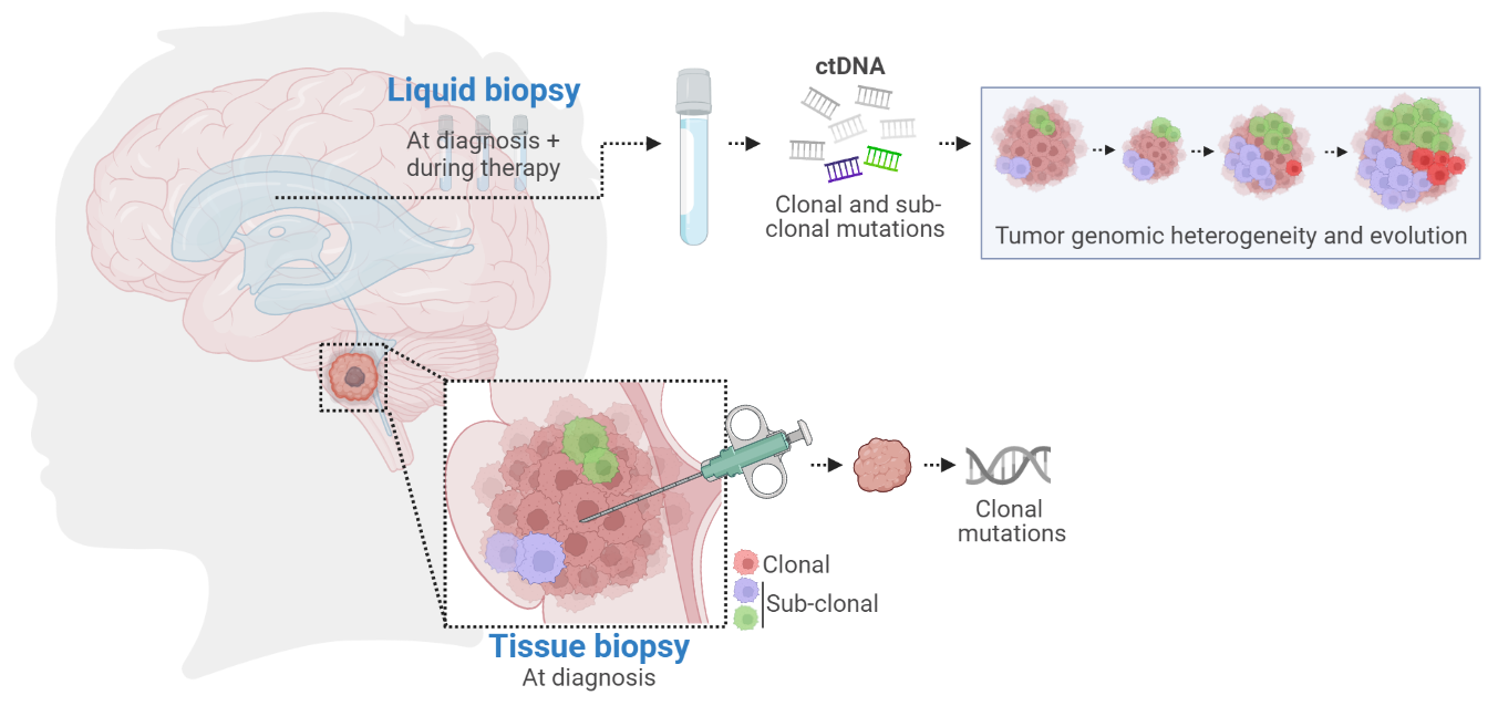 Deep sequencing of circulating tumor DNA uncovers tumor genomic mutations and heterogeneity in pediatric diffuse midline glioma: results from a pilot study 