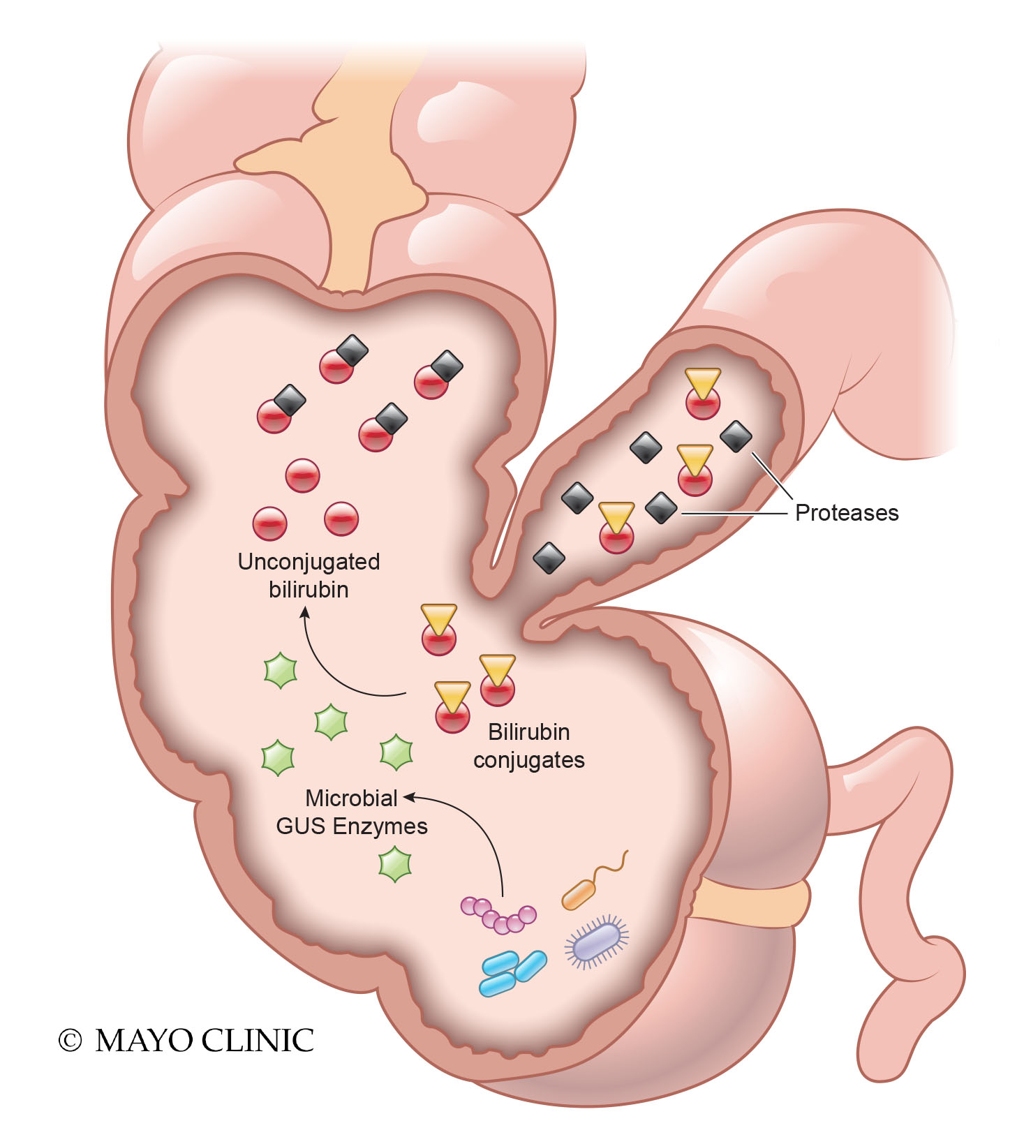 Irritable Bowel Syndrome: A story of missing microbes