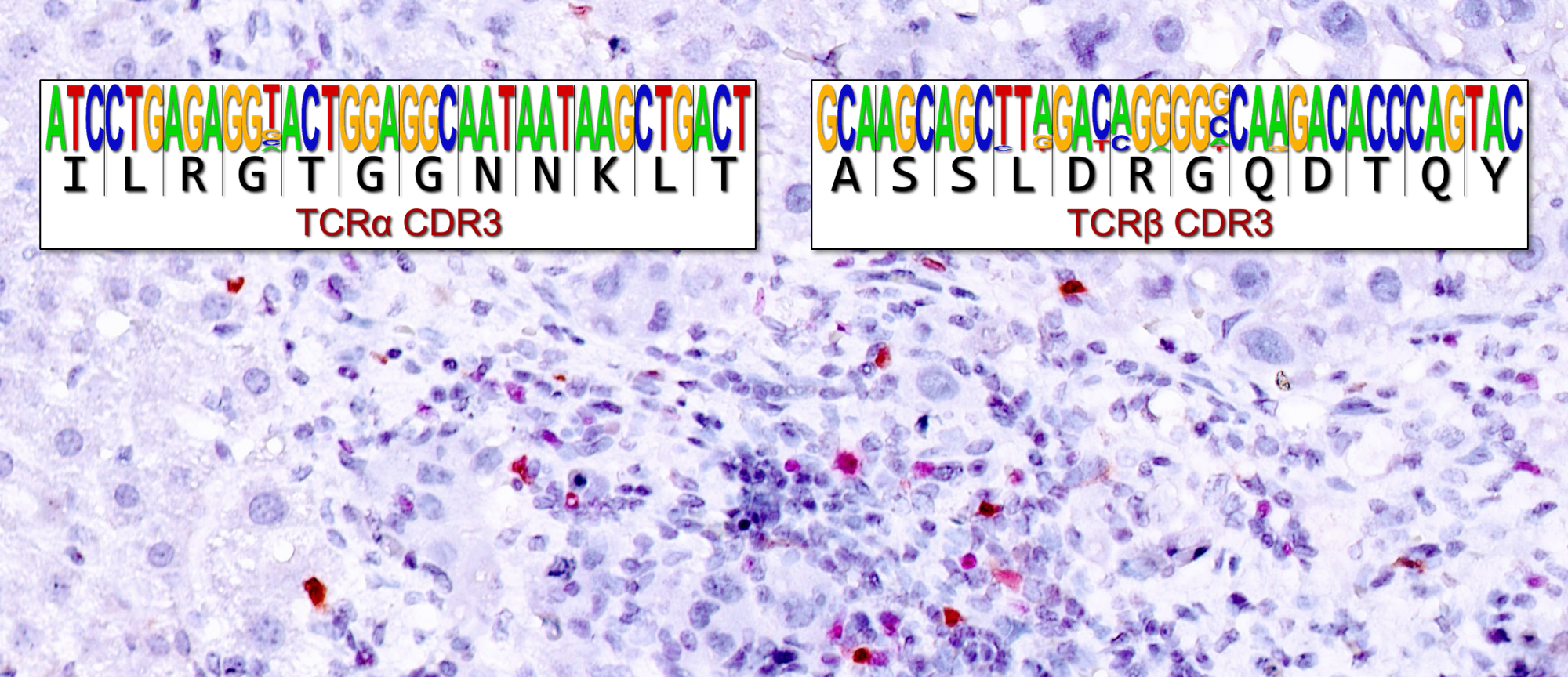 Cholinergic T cells at the center of neuro-immuno-oncology
