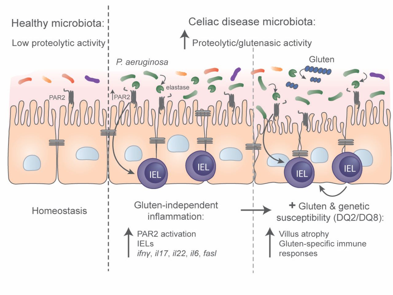 Duodenal bacterial proteolytic activity determines sensitivity to dietary antigen through PAR-2 receptor 