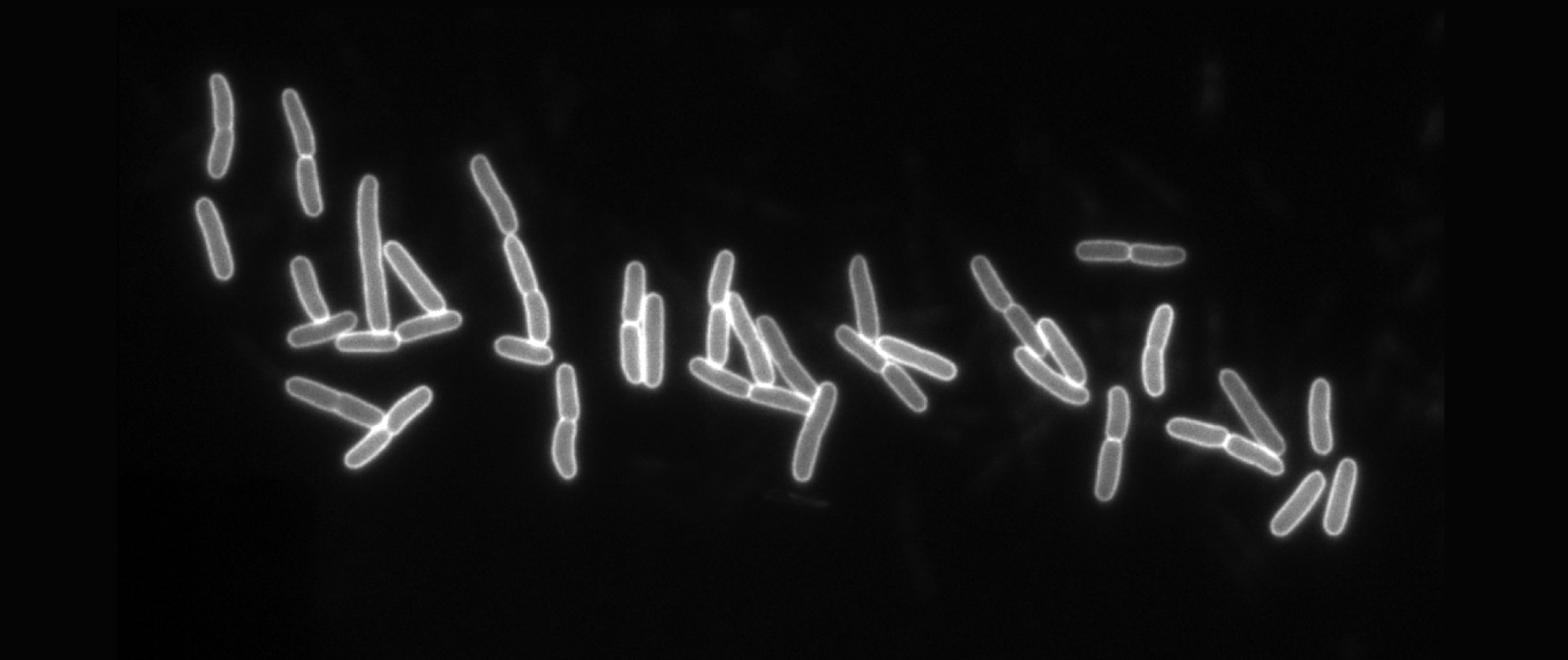 The Mechanical Properties of the Outer Membrane (or, The Border Wall is Not Required for Cell Security)