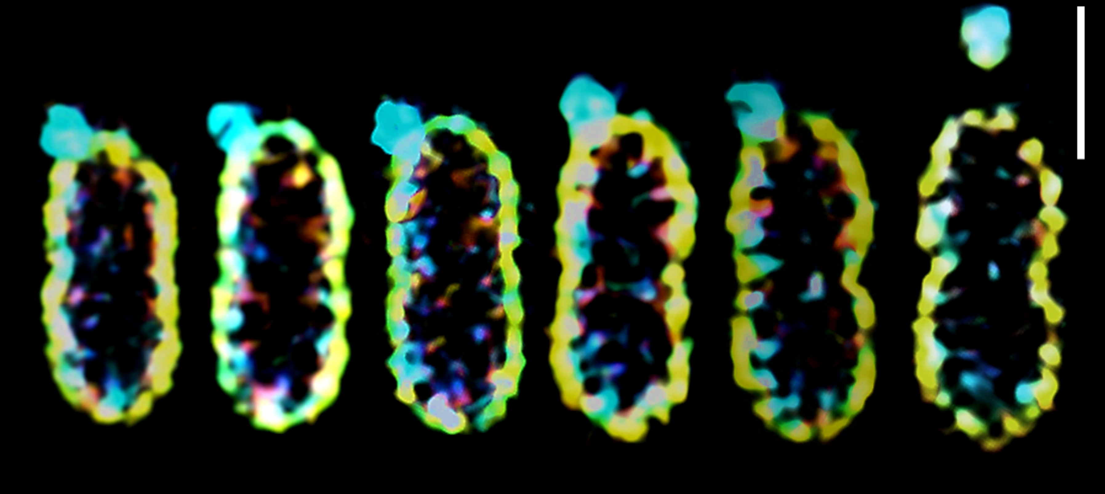 How E. coli renews its outer membrane when growth slows