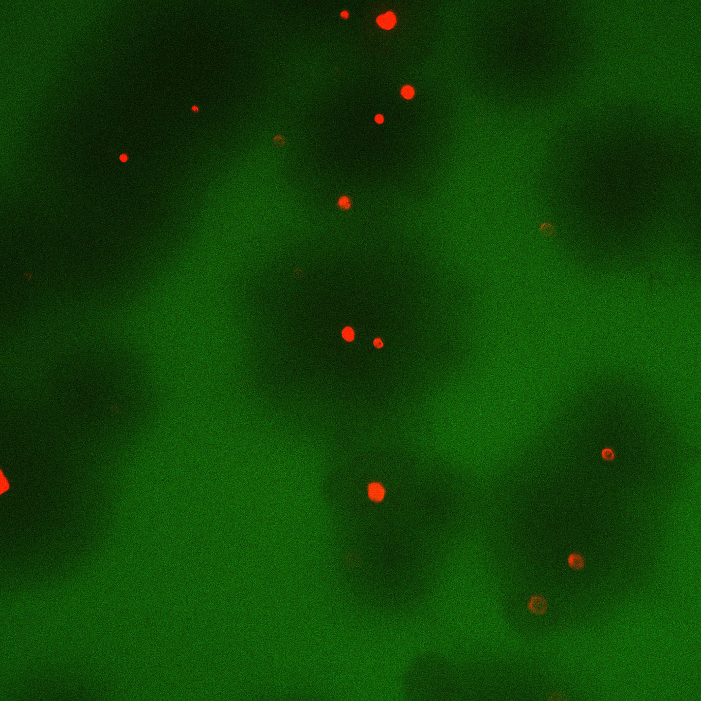 Using bacteriophage virus to tackle bacterial lung infections