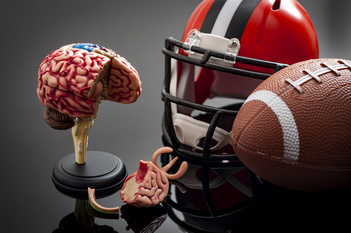 Athletic data depression: Gap in available neuroimaging data and technology limits understanding of effects of sports participation on the brain