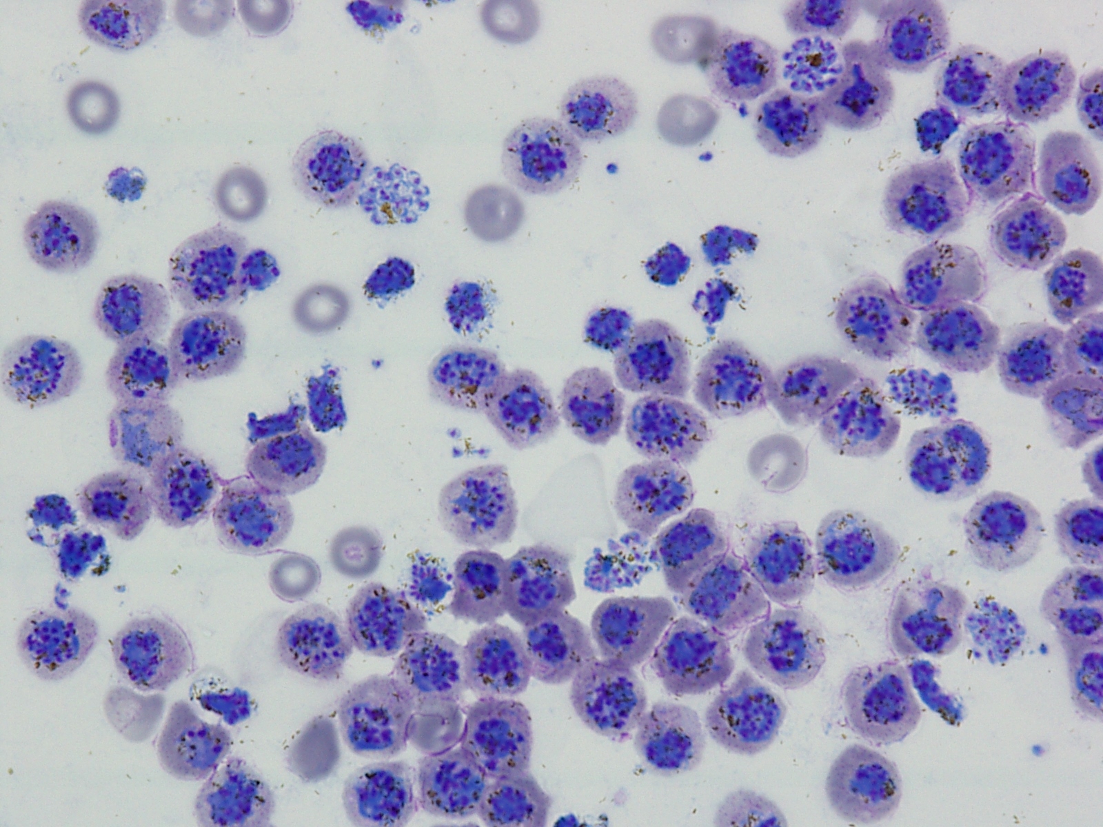 Understanding human vaccine-induced immunity in vivax malaria