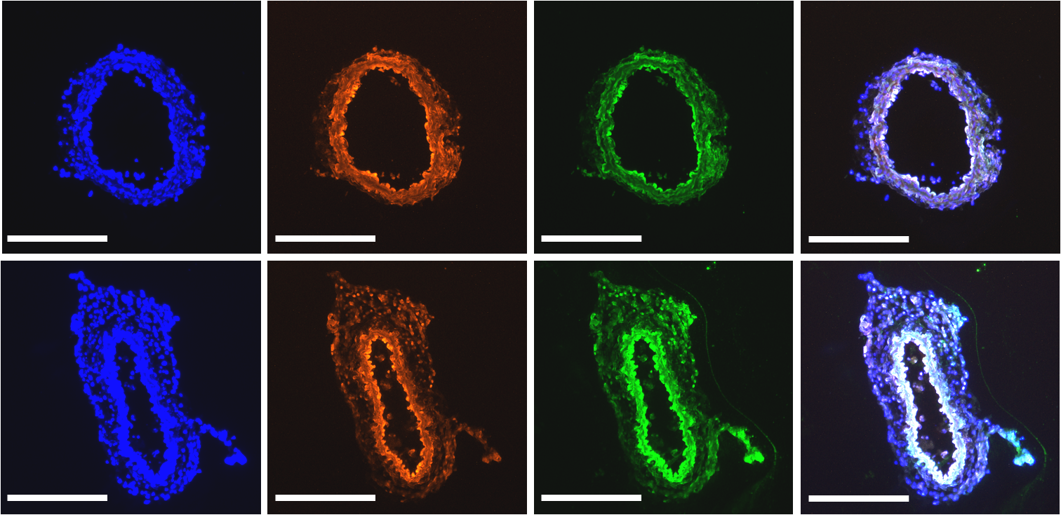 Targeting mechanosensitive cannabinoid receptor 1 with isoflavone prodrugs attenuates atherosclerotic endothelial dysfunction