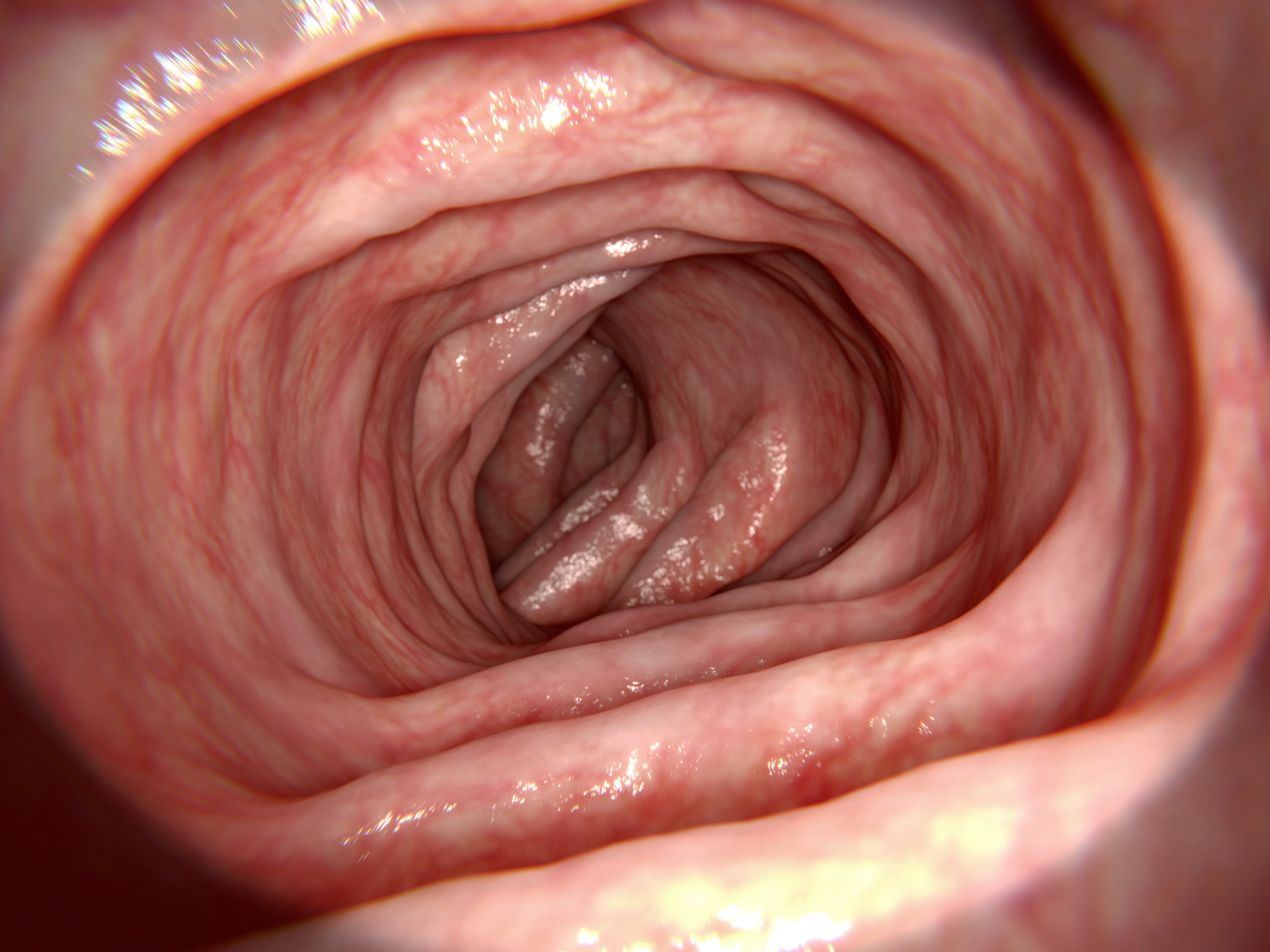 Schrödinger's probiotics and the gut resistome