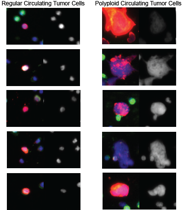 Polyploid cancer cells reveal signatures of chemotherapy resistance 