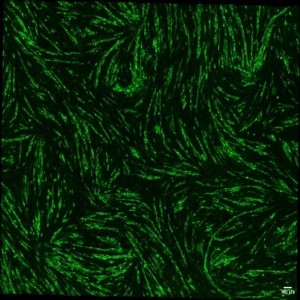Targeting autoimmune B-cells with chimeric autoantibody receptors (CAARs)