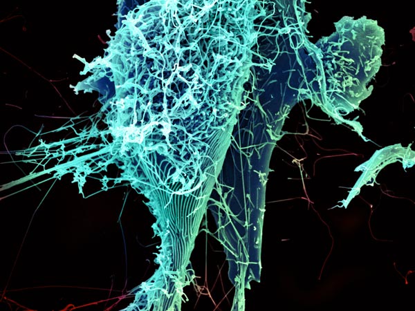 The Ebola Bundibugyo virus outbreak: clinical studies in progress