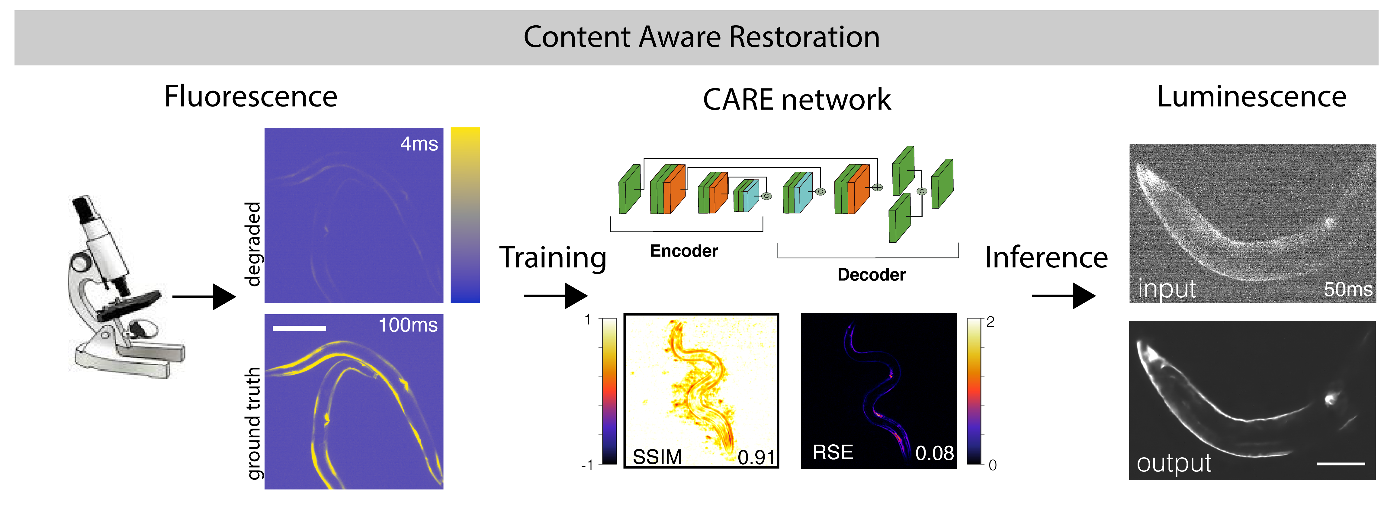 Enhancing bioluminescence microscopy with deep learning