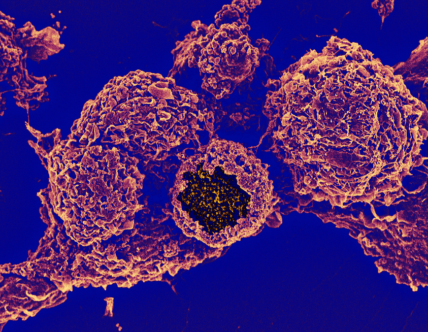 Mysteries of Chlamydia-macrophage relationship revealed using stem cells and CRISPR