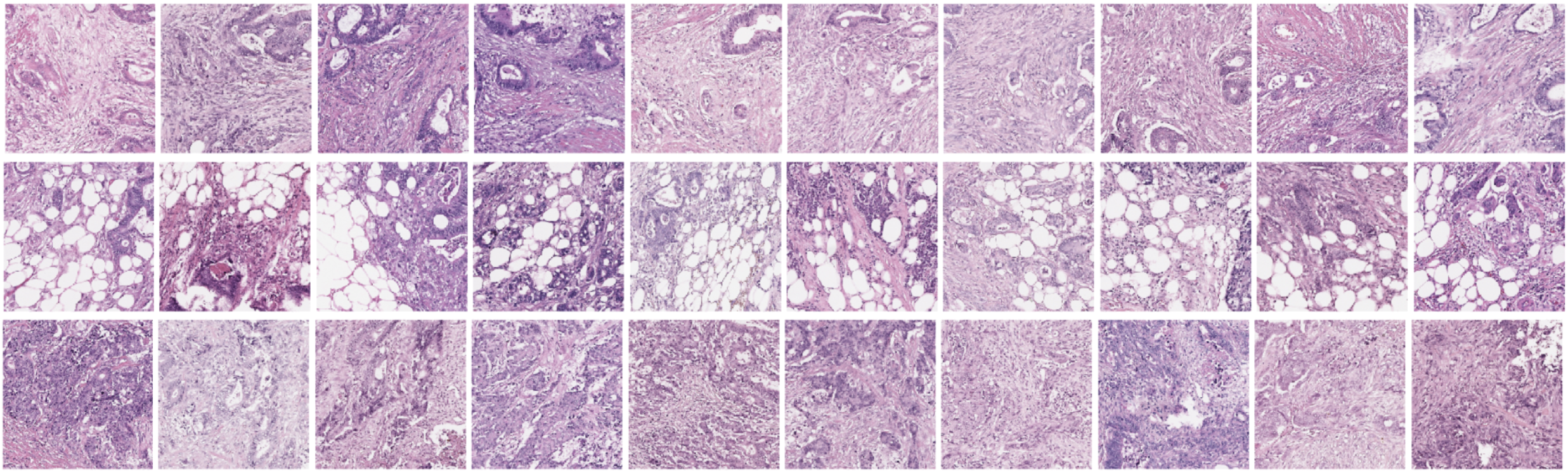 Learning from deep learning: developing interpretable AI approaches in histopathology to predict patient prognosis and explore novel features
