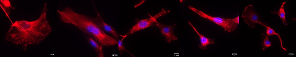 Delineating the differential phenotypic readouts of novel and canonical colorectal cancer NRAS and KRAS mutants