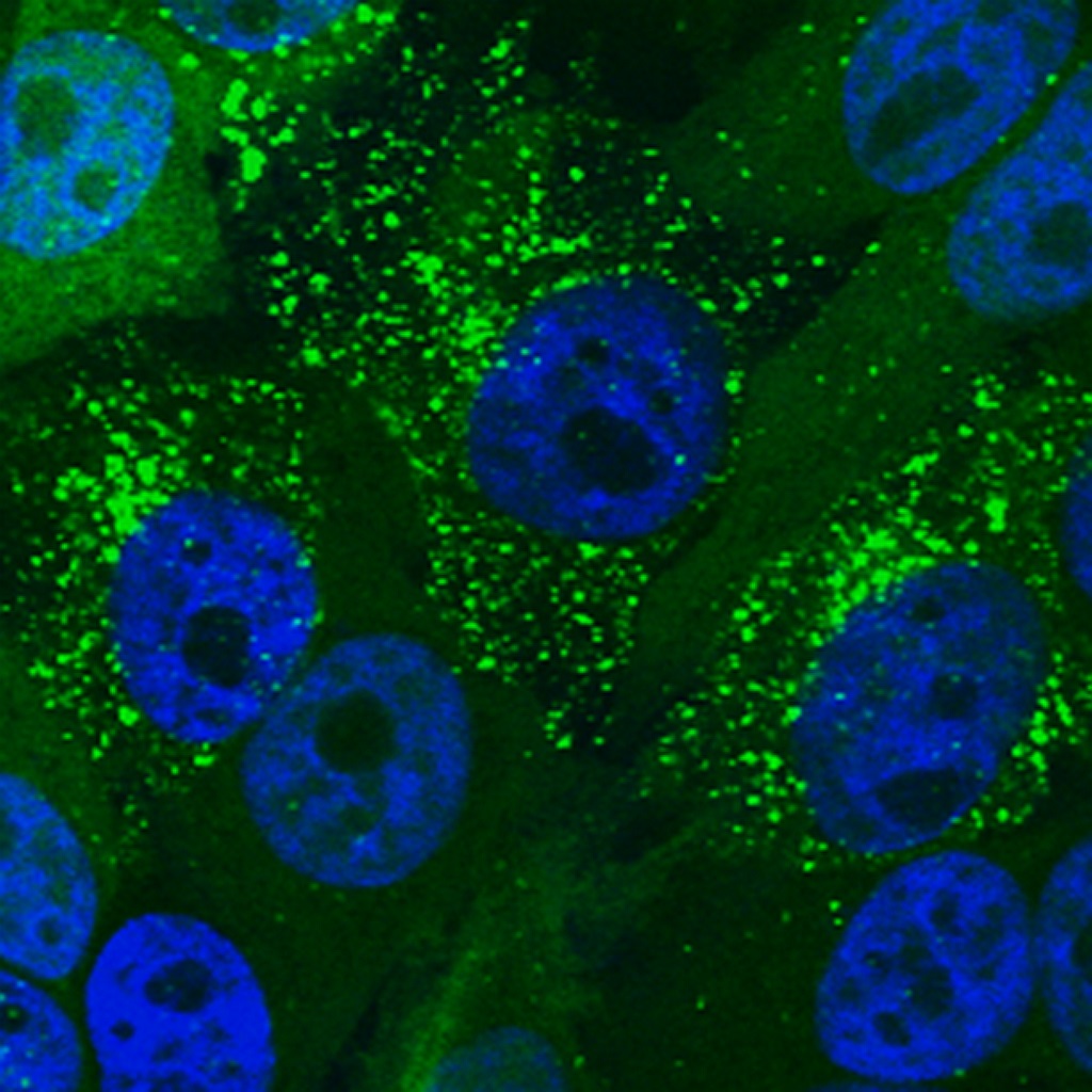 TRIM23: A new player in virus-induced autophagy